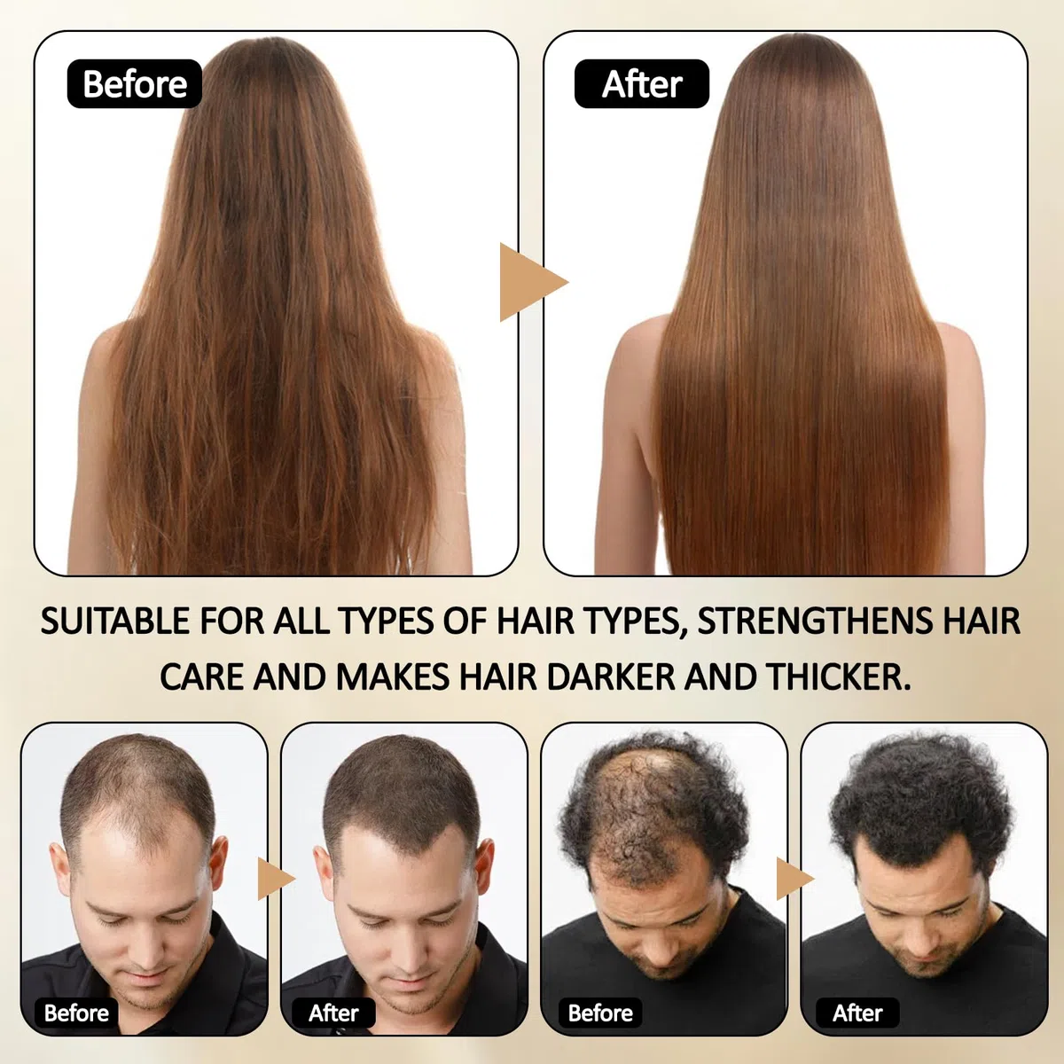 Shampoo Attivatore Radice, Shampoo Anticaduta Crescita Capelli, 100ml, Nero, Unisex Adulto