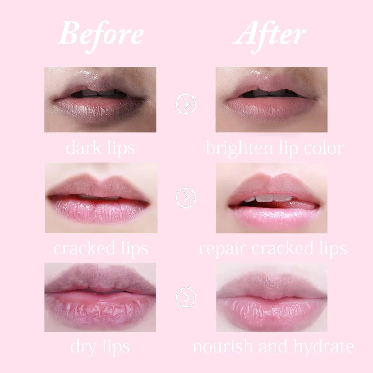 Lip Mask, 15 Pezzi Maschera Volumizzante Labbra, Cuscinetti per Labbra Idratanti, Maschera per Dormire per Labbra per la Cura delle Labbra, Cuscinetti per labbra per Labbra Secche e Screpolate