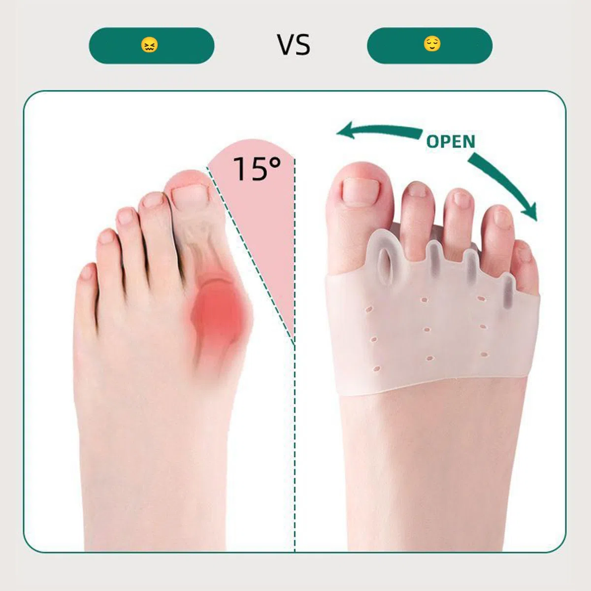 Separatori per dita dei piedi in silicone, separatore per dita dei piedi, per donne, sollievo dall'alluce valgo, raddrizzatore e distanziatore per donne e uomini (4 pezzi)
