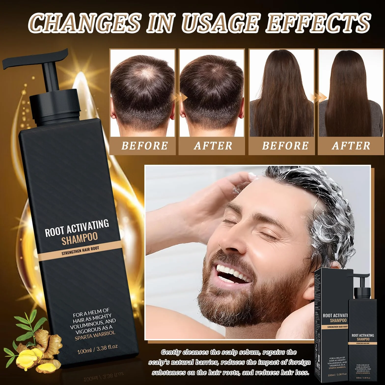 Byhsoep Spart Root Activator Shampoo, 2 Pezzi da 100 ml, Ingredienti Botanici Delicati, Radici dei Capelli Lisce e Lucide/Forti, Adatte sia Agli Uomini che Alle Donne