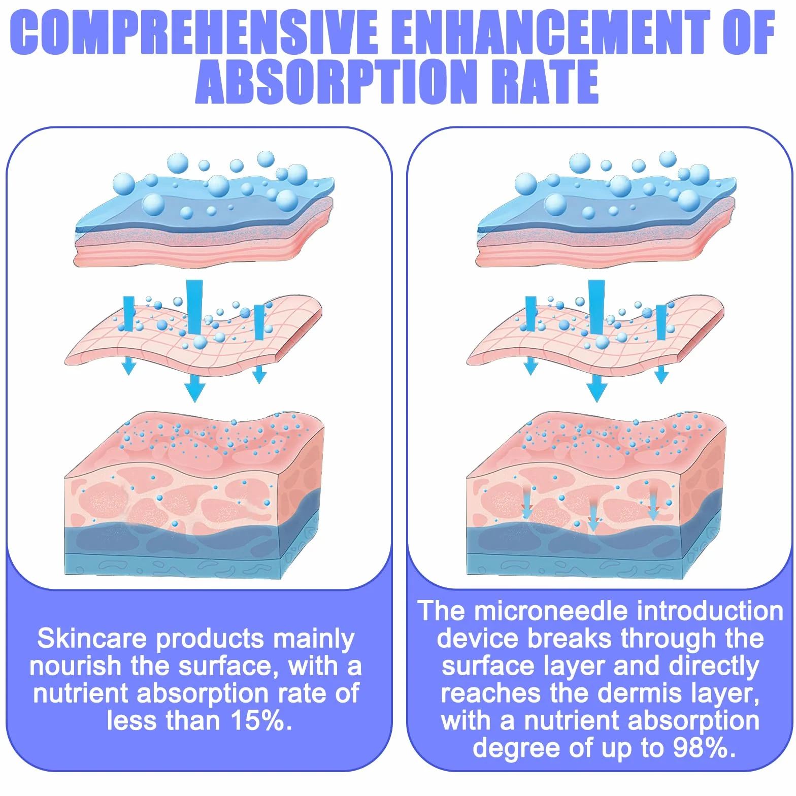 Vaileal - 20 micro aghi di ricambio a 12 pin per Derma Pen per rimuovere l'acne, cicatrici e pieghe di obesità - Blu - Bellezza